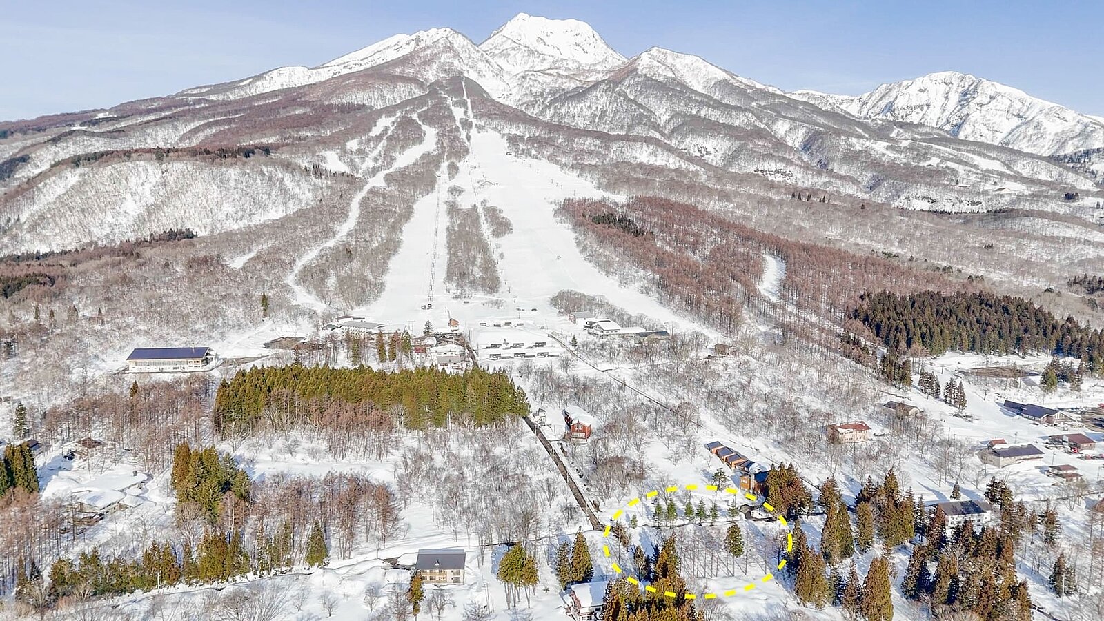 1 Ikenohara Alpine